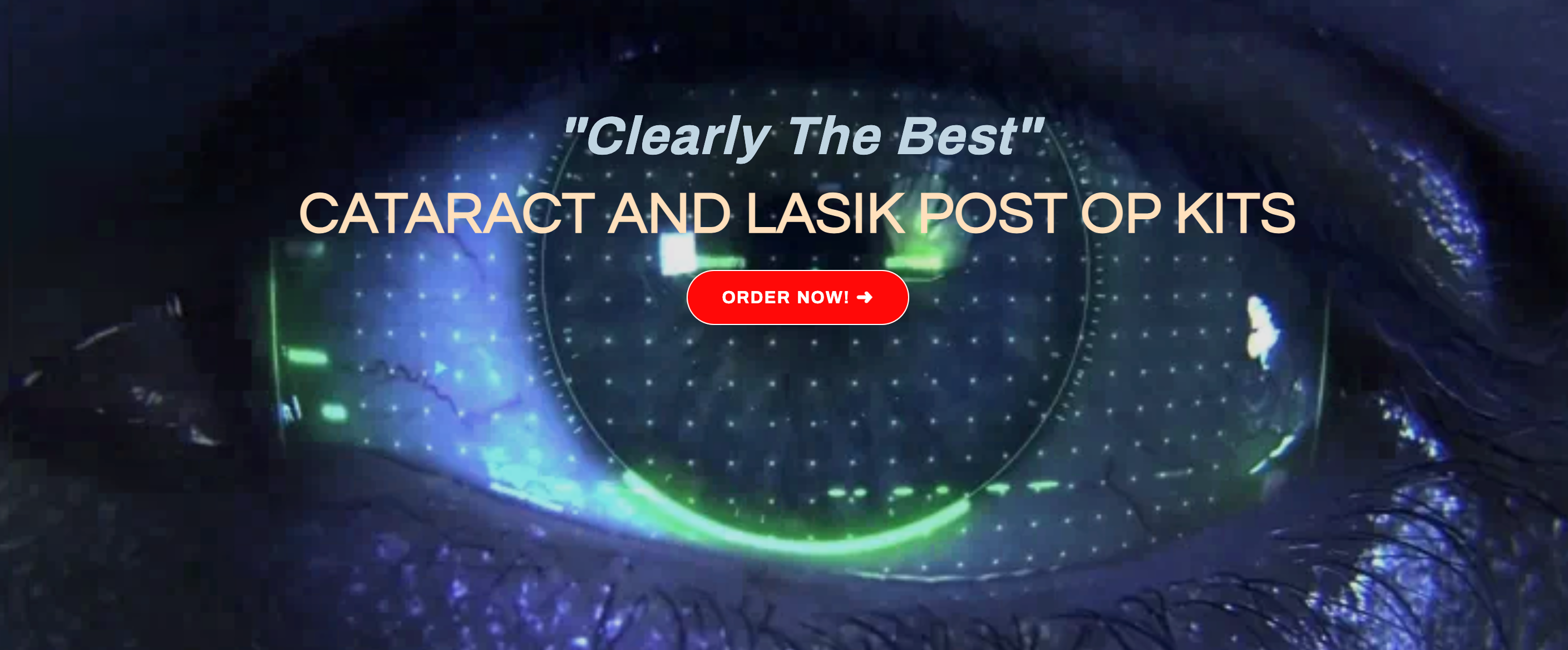 Eye Resolution Kit Ophthalmology Post Surgical Kits for Eye Care Recovery | PinPoint ...